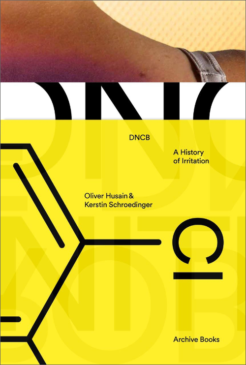 DNCB – A History of Irritation DNCB – A History of Irritation